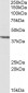 PSMB7 Antibody (internal region)